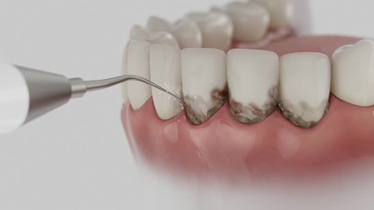 Reliable Dental contractor in Elmore, OH by Smile Center Dentistry